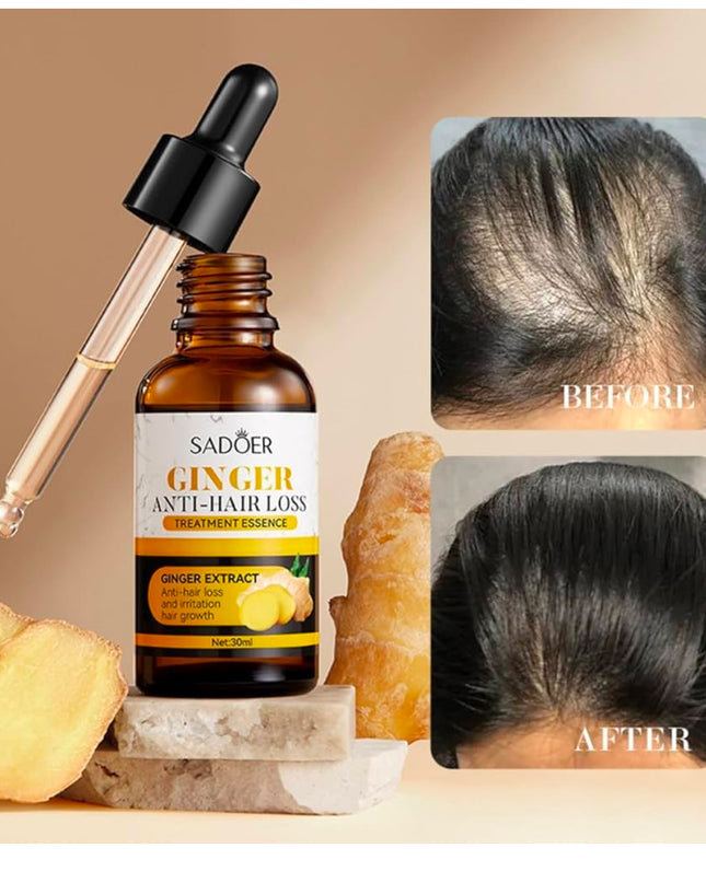 GINGER ANTI -HAIR LOST - SADOER