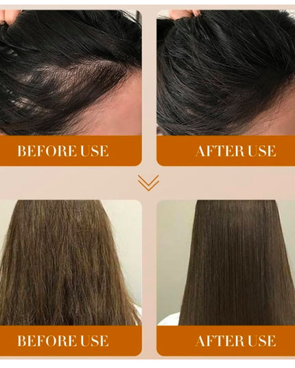 GINGER ANTI -HAIR LOST - SADOER